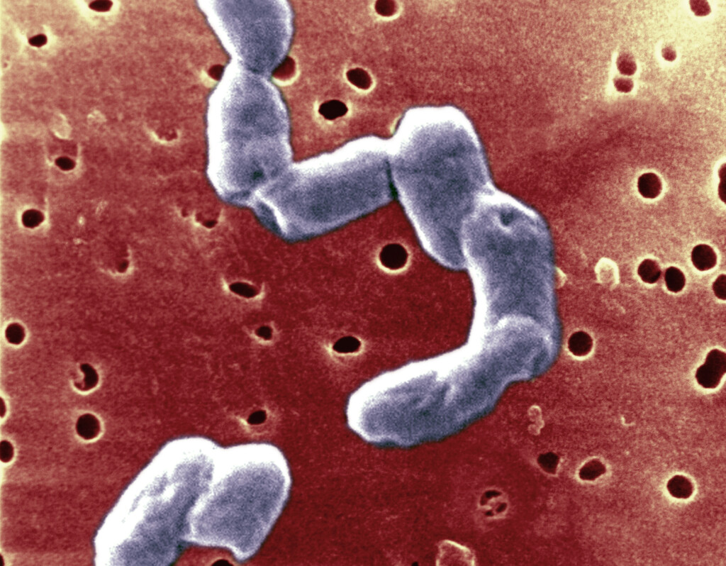 Cluster of salmonella cases linked to West Lafayette ...