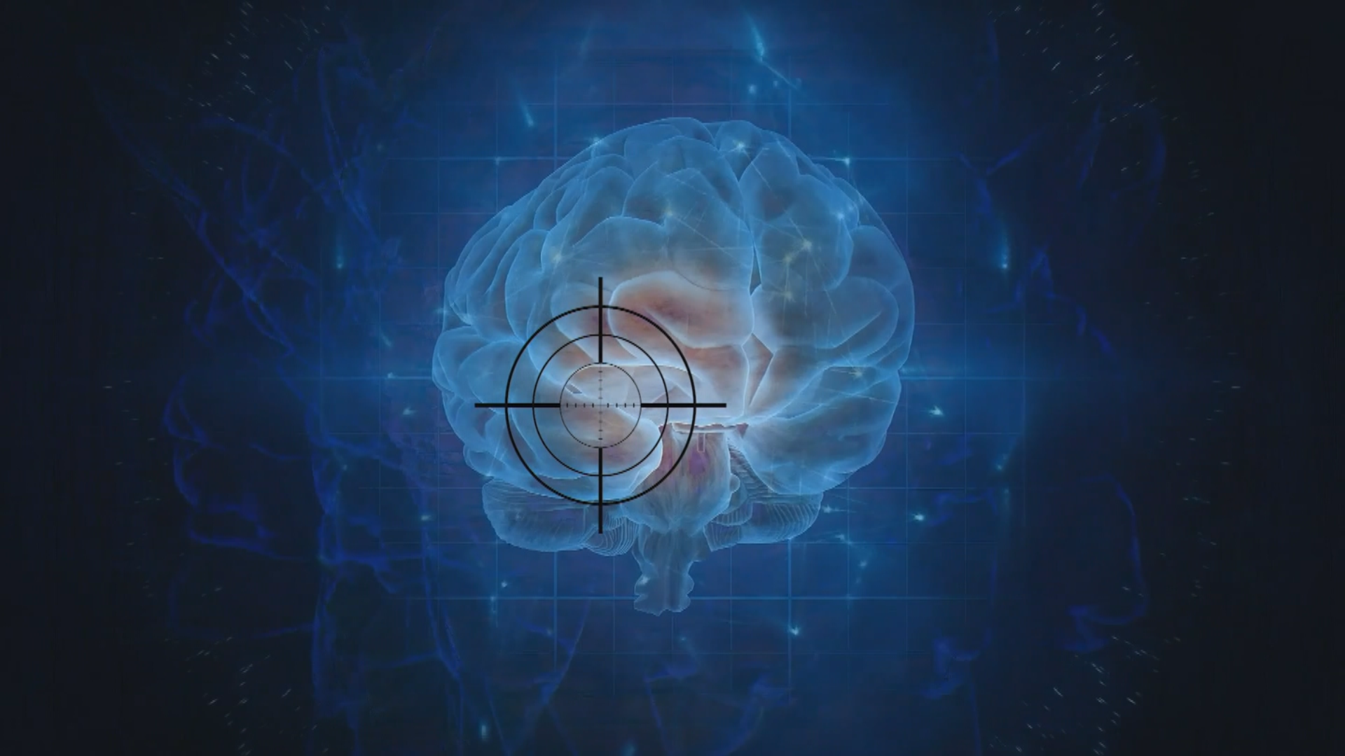 Health Spotlight: Powerful Tesla MRI targeting epilepsy - Indianapolis ...