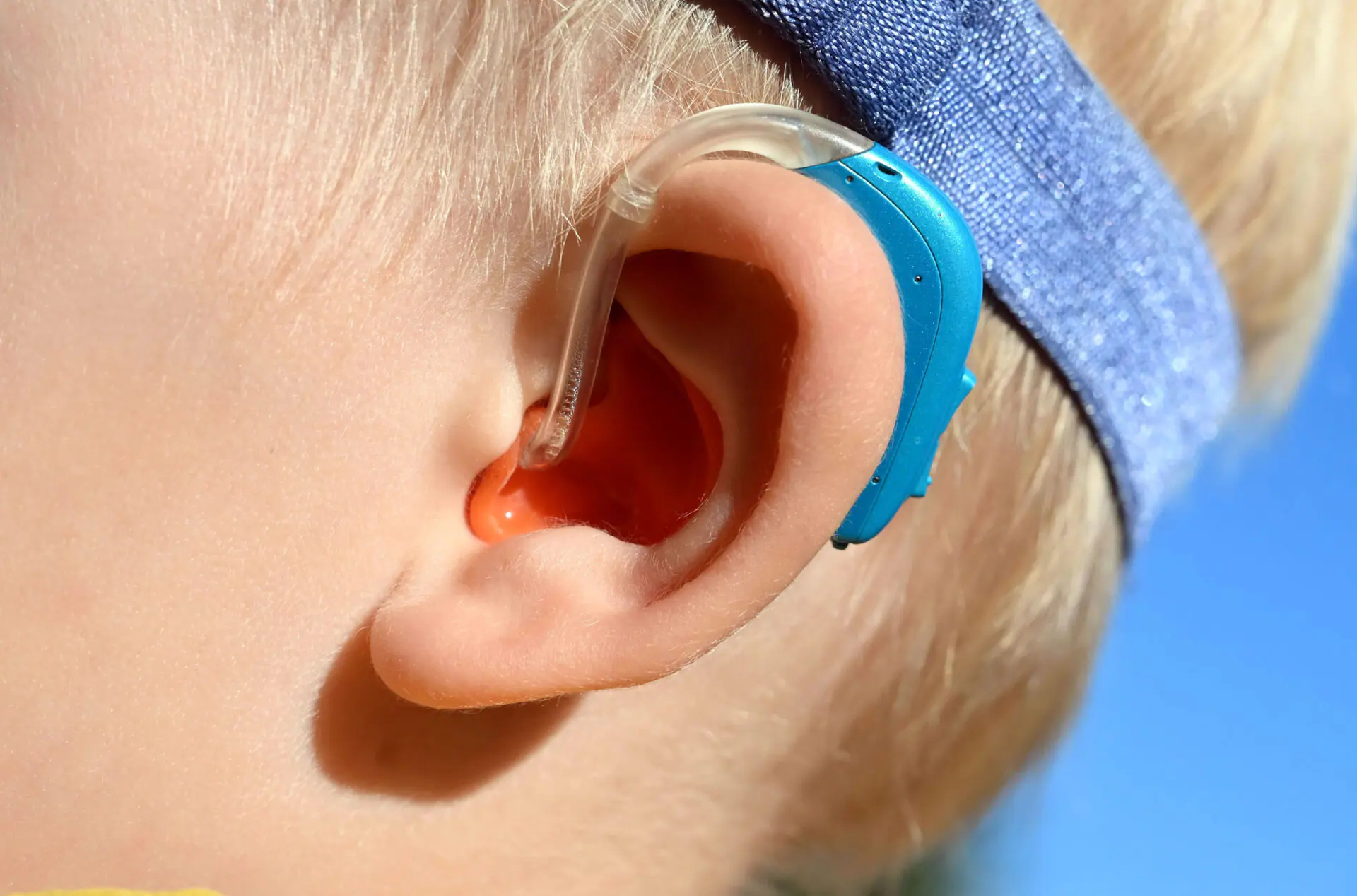 PRODUCTION - 07 September 2024, Baden-Württemberg, Karlsruhe: A two-year-old boy wears a hearing aid. Hearing aids amplify sound acoustically. For this technology to be sufficient, there must still be residual function in the hair cells.(Photo by Uli Deck/picture alliance via Getty Images)